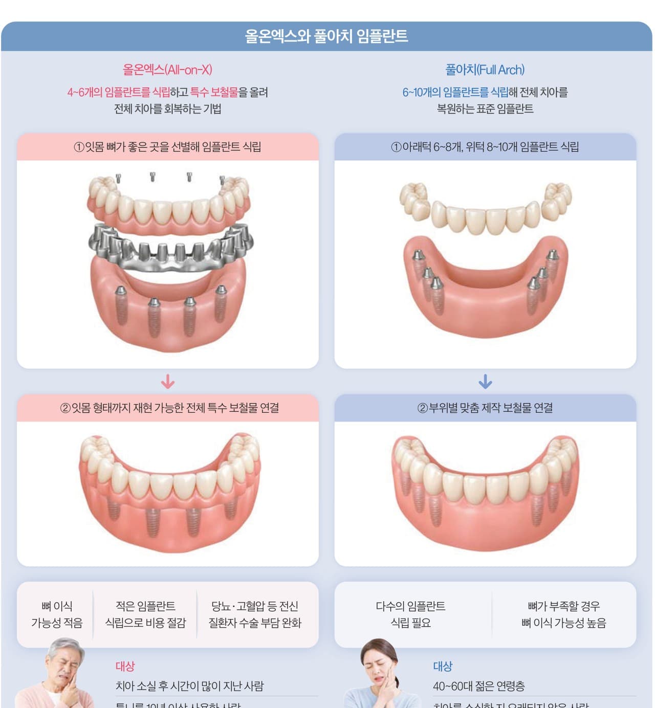 치아 대부분 잃어도 ‘올온엑스’로 해결